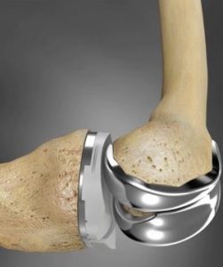 Biocompatibility